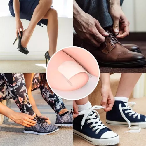 merkloos 40 stuks strips voor het gladmaken van ingegroeide teennagels, inclusief nagellifter, voor de correctie van ingegroeide teennagels. (9509465873675)