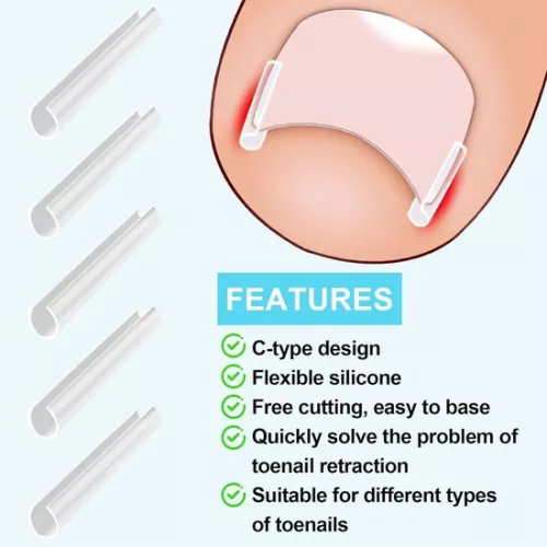 merkloos Set voor het corrigeren van ingegroeide teennagels - 40 pijnloze strips voor het gladmaken van teennagels met teennagellifter (8785322238837)