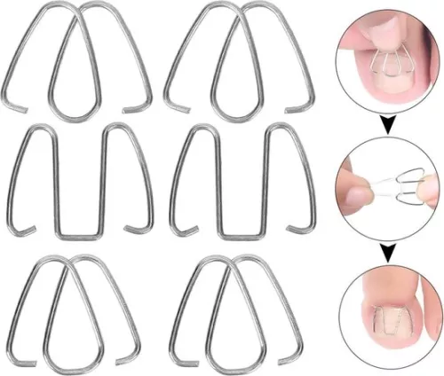 merkloos Ingegroeide teennagelcorrectiehaakje - Nagelcorrectiestrips, draadlifter voor herstel - Corrector voor dames en heren. (8785309165095)