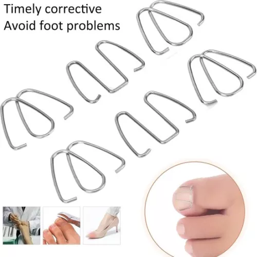 merkloos Ingegroeide teennagelcorrectiehaakje - Nagelcorrectiestrips, draadlifter voor herstel - Corrector voor dames en heren. (8785309165095)